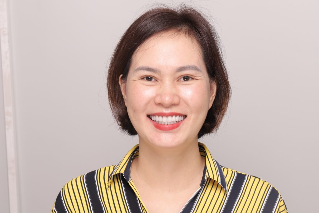 Khi Trải Nghiệm Nha Khoa Thẩm Mỹ Trở Thành Gánh Nặng Tâm Lý