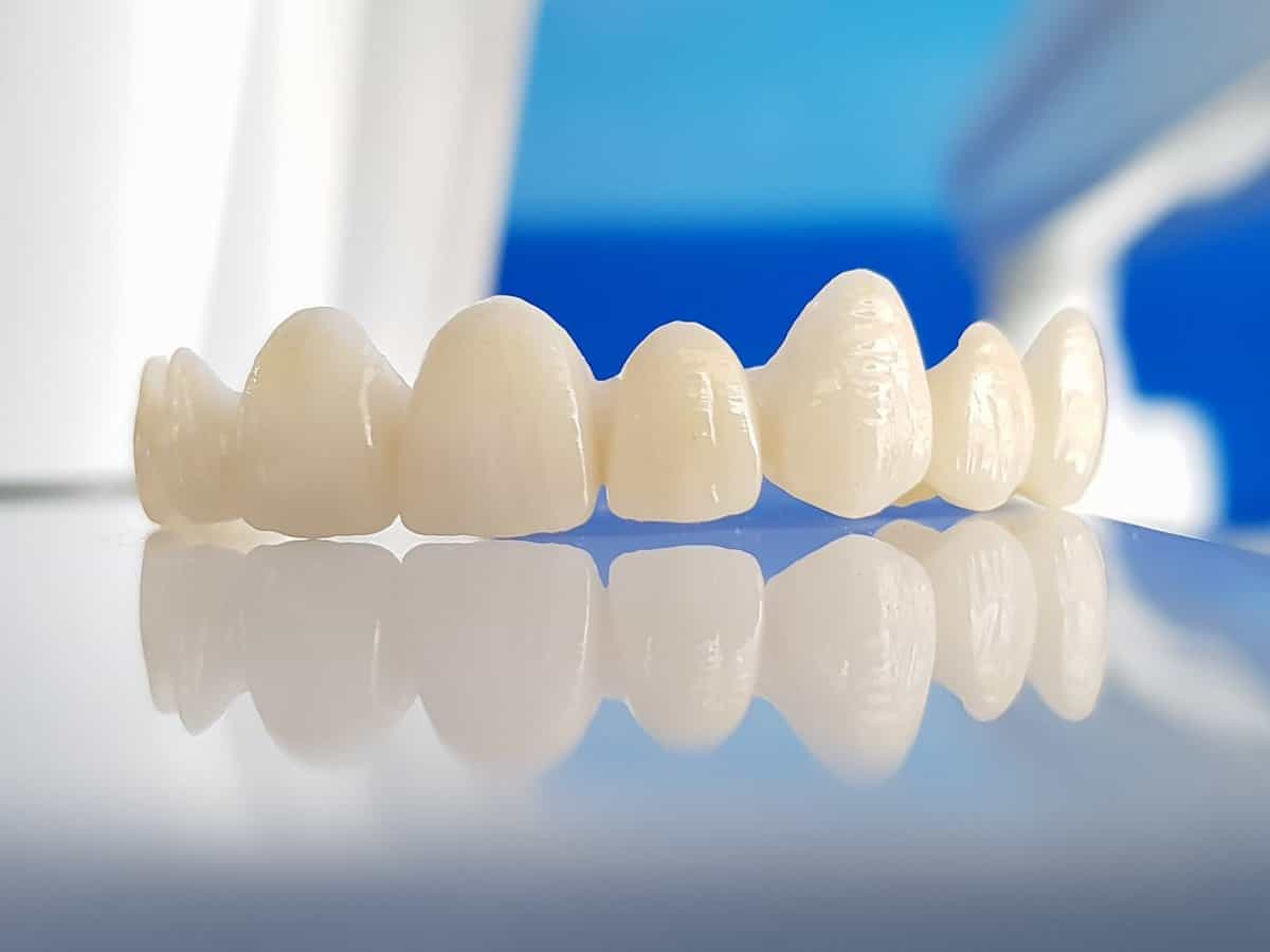 Răng sứ là gì? Dán răng sứ loại nào tốt?